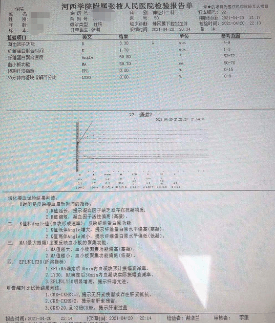 阳光房与冲击检测设备，哪个更好？