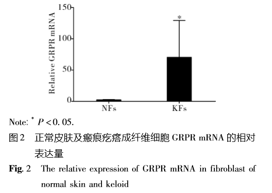 光谱仪滤光片的作用及其重要性解析